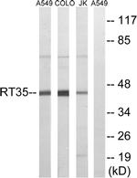 MRPS35 Antibody in Western Blot (WB)