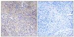 MRPL11 Antibody in Immunohistochemistry (Paraffin) (IHC (P))