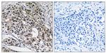 MRPL13 Antibody in Immunohistochemistry (Paraffin) (IHC (P))