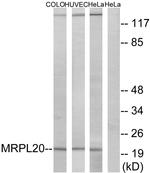 MRPL20 Antibody in Western Blot (WB)