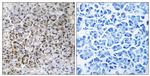 MRPL40 Antibody in Immunohistochemistry (Paraffin) (IHC (P))