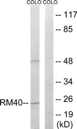 MRPL40 Antibody in Western Blot (WB)