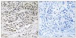 CEP131 Antibody in Immunohistochemistry (Paraffin) (IHC (P))