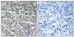 MP68 Antibody in Immunohistochemistry (Paraffin) (IHC (P))