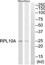 RPL10A Antibody in Western Blot (WB)