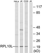 RPL10L Antibody in Western Blot (WB)