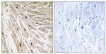 RPL22 Antibody in Immunohistochemistry (Paraffin) (IHC (P))