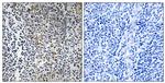 RPL23 Antibody in Immunohistochemistry (Paraffin) (IHC (P))