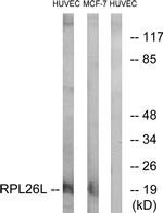 RPL26L1 Antibody in Western Blot (WB)