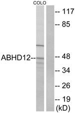 ABHD12 Antibody in Western Blot (WB)