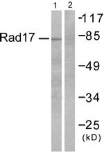 ABHD14A Antibody in Western Blot (WB)