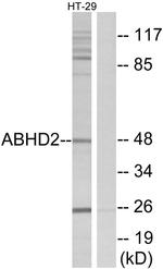 ABHD2 Antibody in Western Blot (WB)