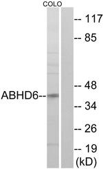 ABHD6 Antibody in Western Blot (WB)
