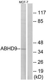 ABHD9 Antibody in Western Blot (WB)