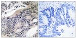 ACSS1 Antibody in Immunohistochemistry (Paraffin) (IHC (P))