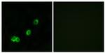 ACOT1 Antibody in Immunocytochemistry (ICC/IF)