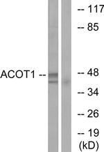 ACOT1 Antibody in Western Blot (WB)