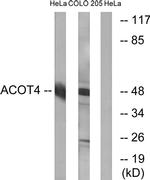 ACOT4 Antibody in Western Blot (WB)