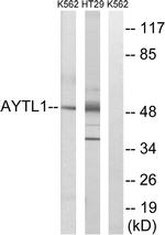 LPCAT2 Antibody in Western Blot (WB)
