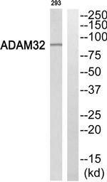 ADAM32 Antibody in Western Blot (WB)