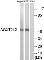 PHYKPL Antibody in Western Blot (WB)
