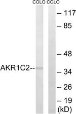AKR1C2 Antibody in Western Blot (WB)