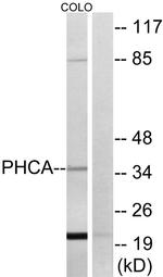 ACER3 Antibody in Western Blot (WB)