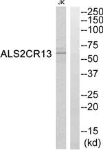 FAM117B Antibody in Western Blot (WB)