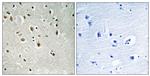 A20A3 Antibody in Immunohistochemistry (Paraffin) (IHC (P))
