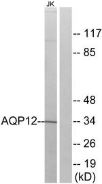 Aquaporin 12 Antibody in Western Blot (WB)