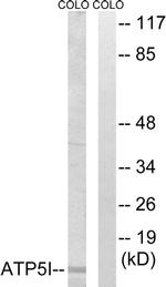 ATP5I Antibody in Western Blot (WB)