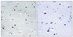 DDX24 Antibody in Immunohistochemistry (Paraffin) (IHC (P))