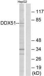 DDX51 Antibody in Western Blot (WB)