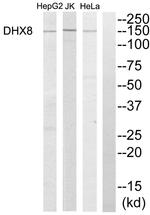 DHX8 Antibody in Western Blot (WB)