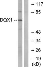 DQX1 Antibody in Western Blot (WB)