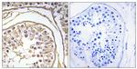 BAGE2 Antibody in Immunohistochemistry (Paraffin) (IHC (P))
