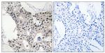 BAGE4 Antibody in Immunohistochemistry (Paraffin) (IHC (P))
