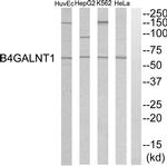 B4GALNT1 Antibody in Western Blot (WB)