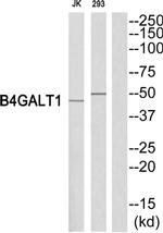 B4GALT1 Antibody in Western Blot (WB)