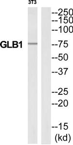 beta Galactosidase Antibody in Western Blot (WB)