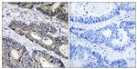 GLB1L3 Antibody in Immunohistochemistry (Paraffin) (IHC (P))