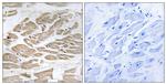 BRP44L Antibody in Immunohistochemistry (Paraffin) (IHC (P))