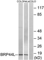 BRP44L Antibody in Western Blot (WB)