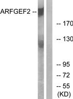 ARFGEF2 Antibody in Western Blot (WB)
