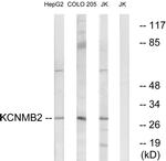 KCNMB2 Antibody in Western Blot (WB)