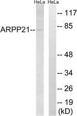 ARPP21 Antibody in Western Blot (WB)