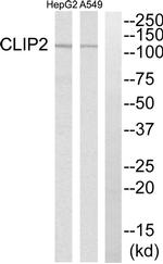 CLIP2 Antibody in Western Blot (WB)