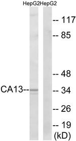 Carbonic Anhydrase XIII Antibody in Western Blot (WB)
