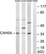Carbonic Anhydrase VA Antibody in Western Blot (WB)