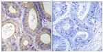 CBR3 Antibody in Immunohistochemistry (Paraffin) (IHC (P))